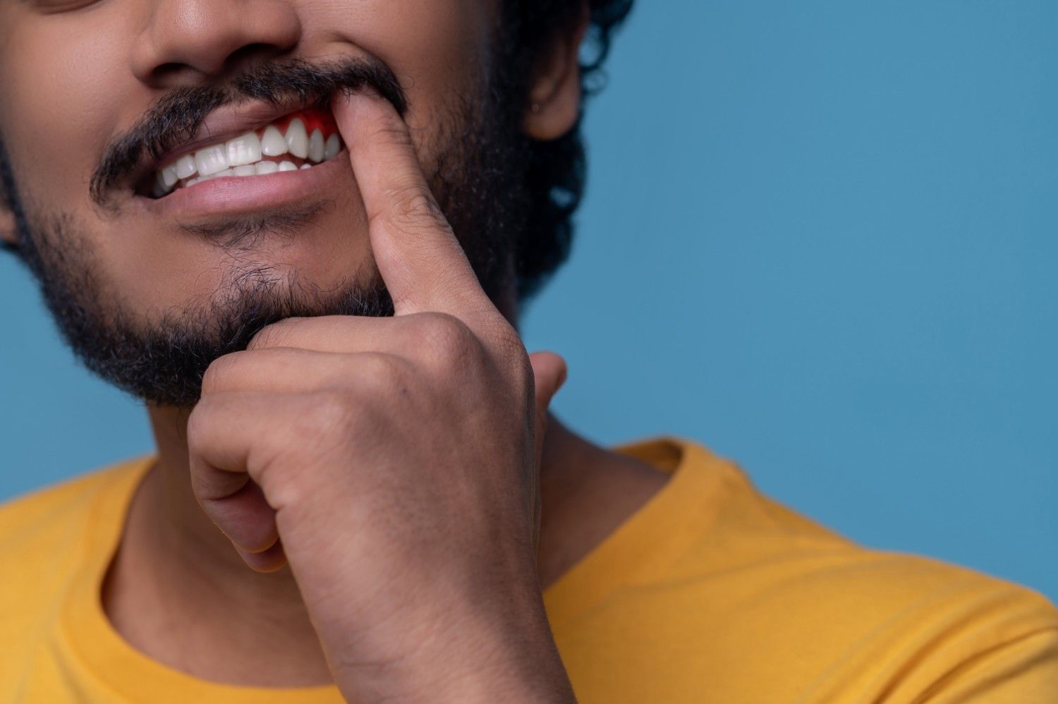 Gum Disease Treatment in Malviya Nagar