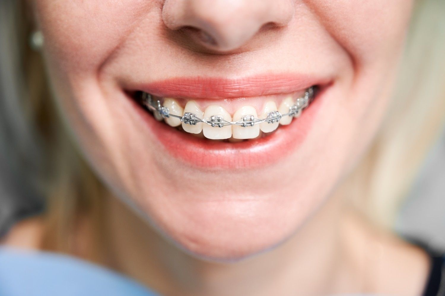 Orthodontic Treatment Doctor in Malviya Nagar