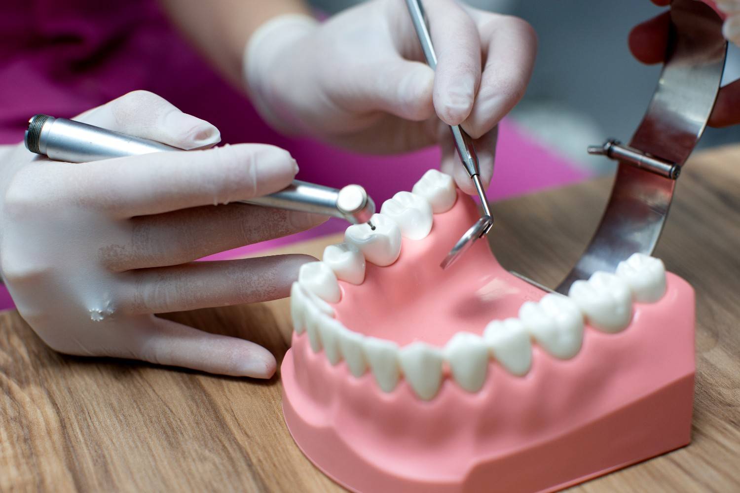 Dental Crowns and Bridges in Malviya Nagar